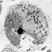 Newly Discovered Fat Molecule: An Undersea Killer with an Upside