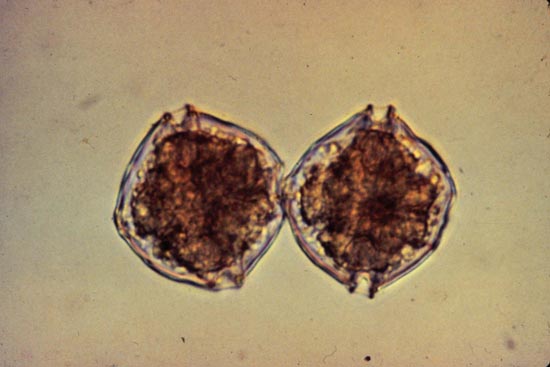 Cells of alexandrium.