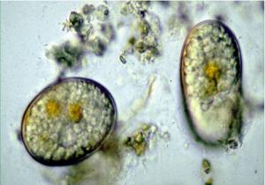 Alexandrium fundyense