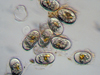 hab cells under microscope