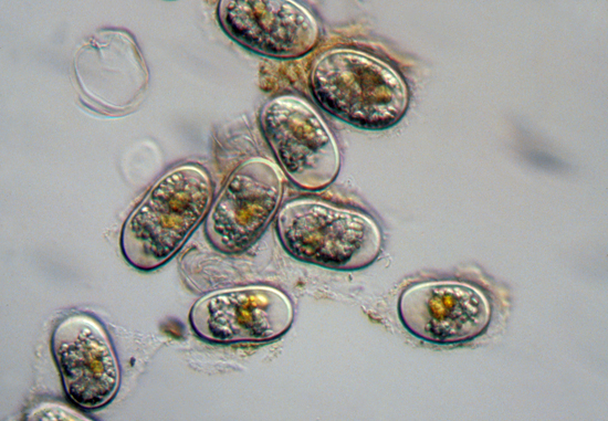 hab cells under microscope