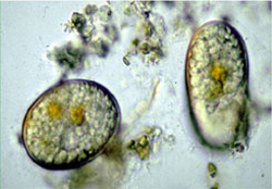 cysts