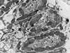 electron micrograph of bacteria living inside a marine ciliate