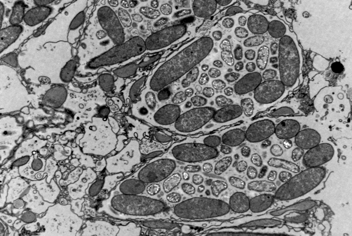 electron micrograph of bacteria living inside a marine ciliate