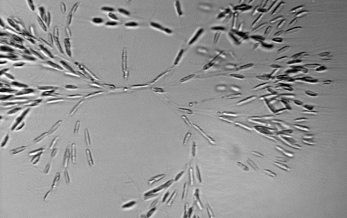 dinobryon bloom under ice