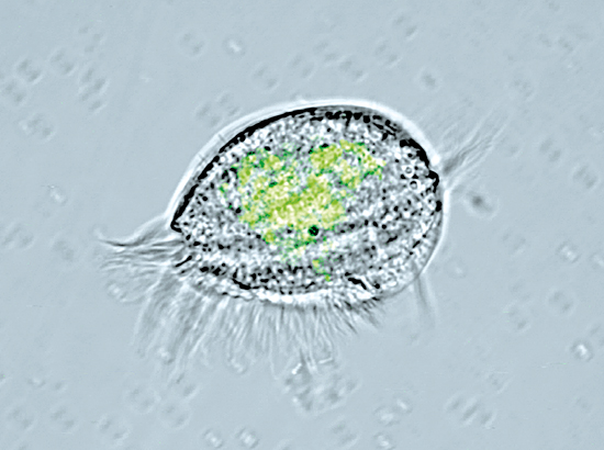euplotes