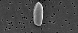 Vibrio parahaemolyticus