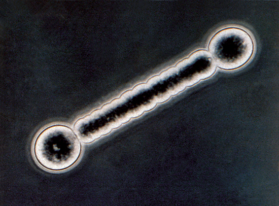 barbell bacteria