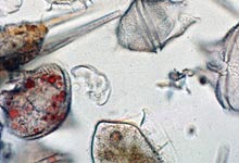 Woods Hole Center for Oceans & Human Health