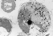 Lipids in Marine Microbes