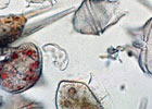 Woods Hole Center for Oceans and Human Health