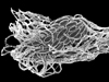 SEM of protist covered with symbiotic bacteria