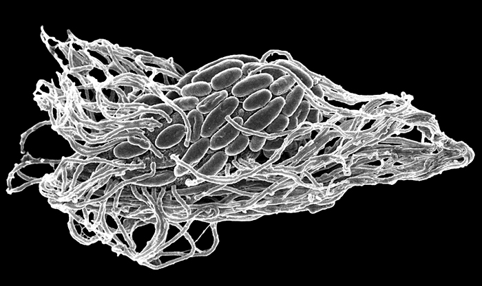 SEM of protist covered with symbiotic bacteria