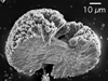 Calcium carbonate crystals