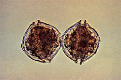 red tide, Cells of alexandrium