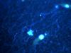 brightly-stained kinetoplastid, a protist, from a DHAB in Mediterranean