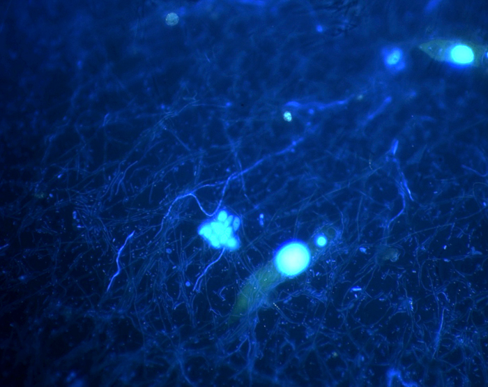 brightly-stained kinetoplastid, a protist, from a DHAB in Mediterranean