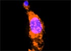 Novel kinetoplastids discovered in Discovery Basin Halocline