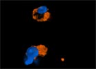 Unidentified Dinoflagellate living in Halocline of Discovery Basin