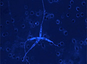 Deep Marine Subsurface Eukaryotes