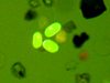 Primulin stained Alexandrium fundyense/tamarense cysts amongst other organic matter.