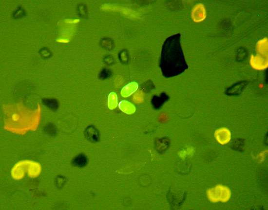 Primulin stained Alexandrium fundyense/tamarense cysts amongst other organic matter.