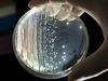 petri dish with specimens