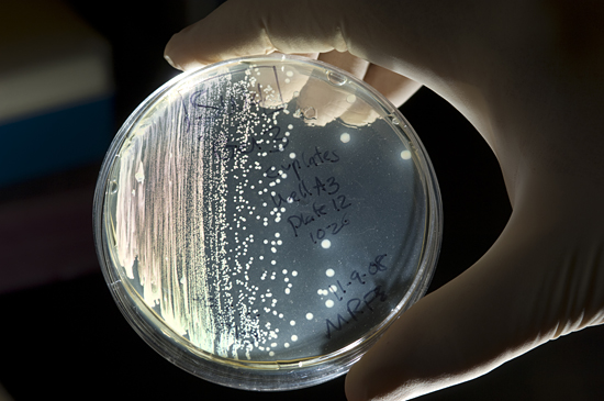 petri dish with specimens