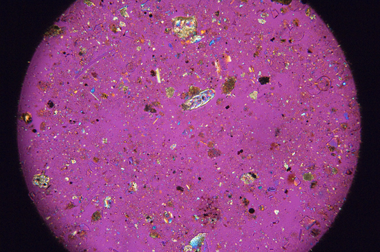 sediment sample through microscope