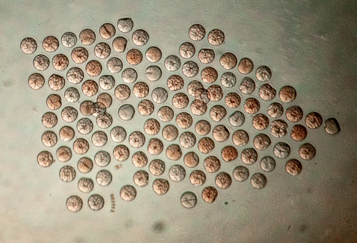 Copepod eggs laid by females collected in Bering Sea by Carin Ashjian