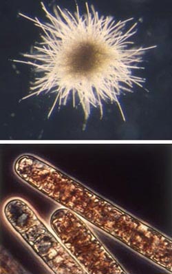 Trichodesmium colony and individuals