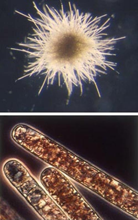 Trichodesmium colony and individuals