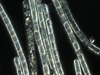 micrograph of a colony of Trichodesmium sp.