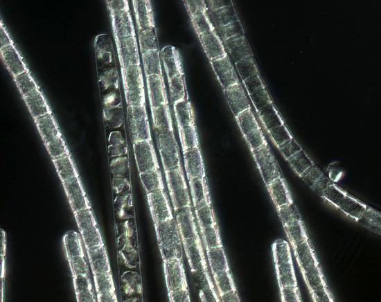 chain of bacteria