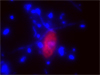 fluorescence micrograph of dinoflagellate and bacteria from Discovery Basin in the Mediterranean