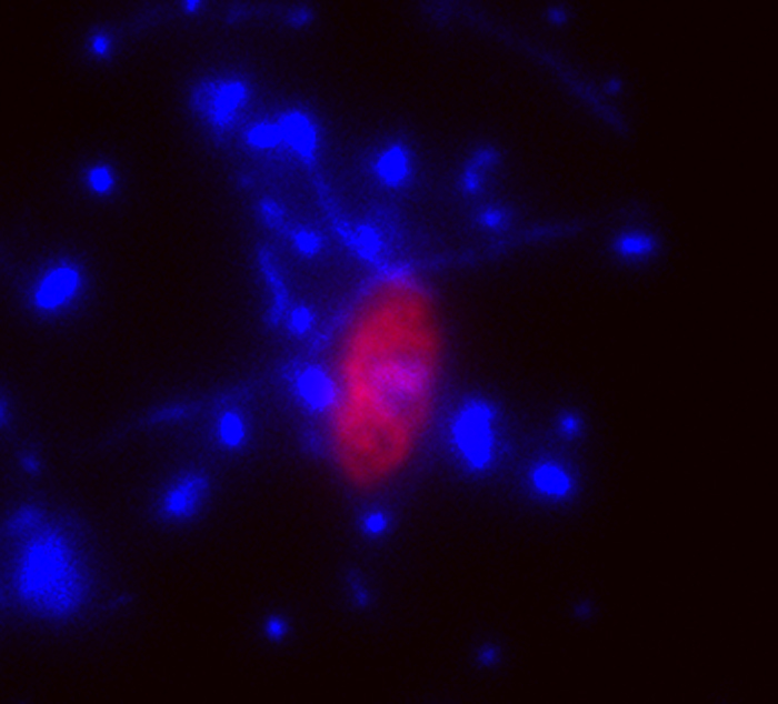 fluorescence micrograph of dinoflagellate and bacteria from Discovery Basin in the Mediterranean
