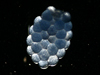  Euchaeta norvegica egg sac.
