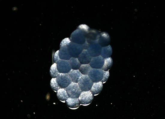  Euchaeta norvegica egg sac.
