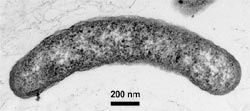 new genus of bacteria called Arcobacter