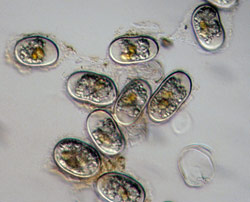 Scanning electron microscope view of cysts of the toxic alga Alexandrium tamarense.