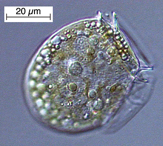 The dinoflagellate Dinophysis