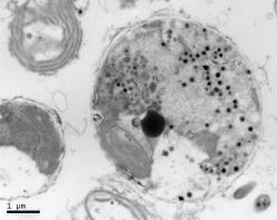 photomicrograph 