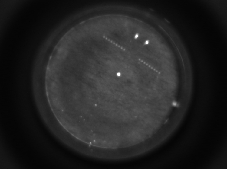 HAB under microscope