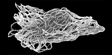 Dozens of oval bacteria