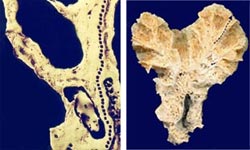 coral analysis