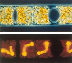 Richelia are cyanobacteria that live symbiotically inside single-celled marine plants called diatoms.