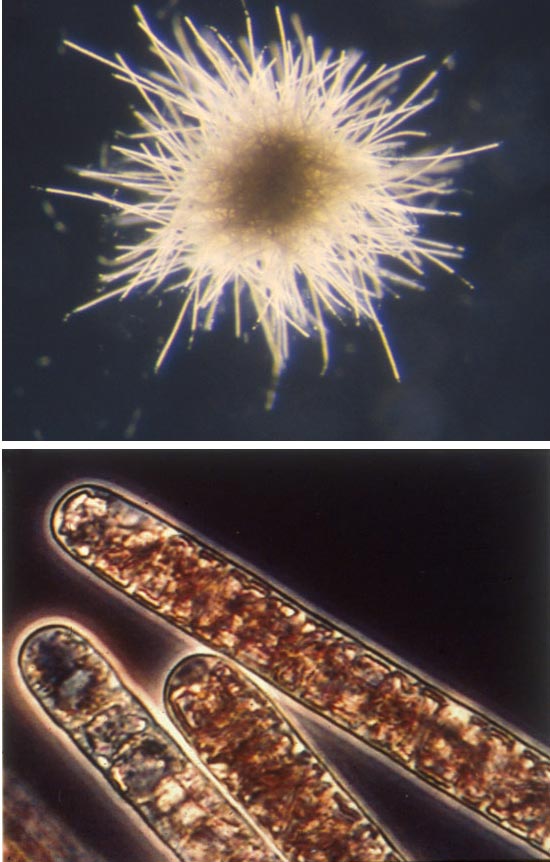 cyanobacterium