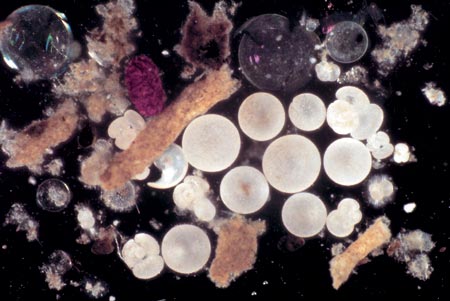 One of the first photographs of a sediment trap sample shows cylindrical fecal pellets and other aggregates, planktonic tests (round white objects), transparent snail-like pteropod shells, radiolarians, and diatoms.