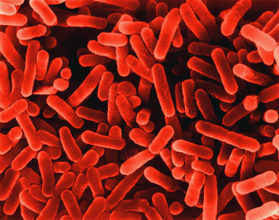 SEM photo of legionella bacterium