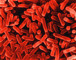 SEM photo of legionella bacterium